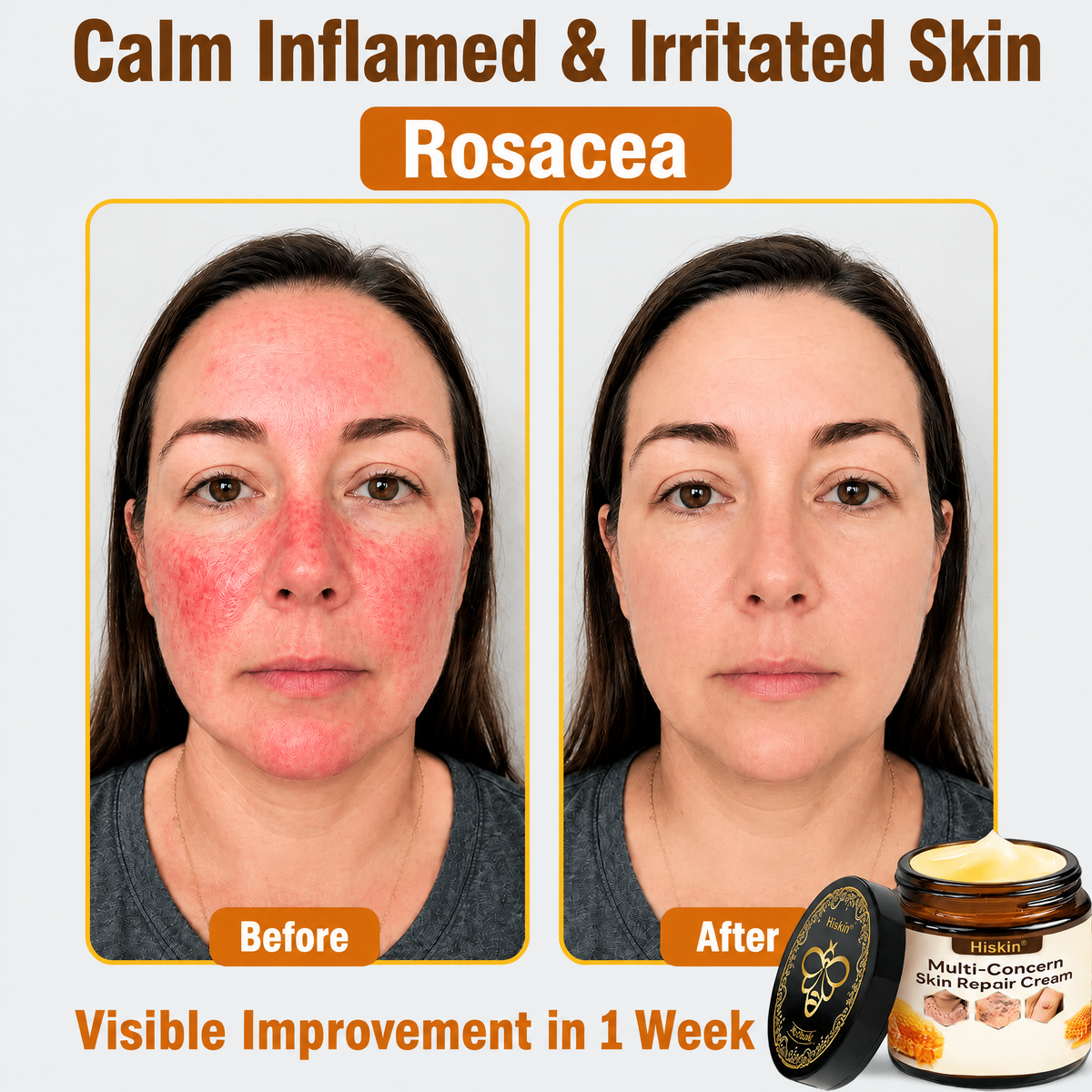 ✨HISKIN® Multi-Concern Skin Repair Cream (One powerful cream to repair inflammation, dryness, aging, pigmentation, and visible skin damage.)
